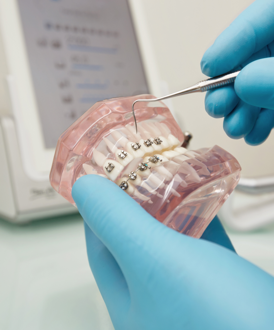 Apparecchio trasparente Brescia